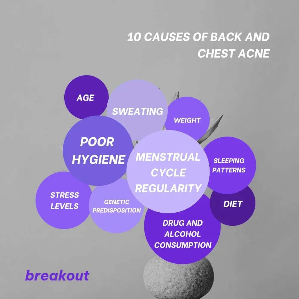 Infographic explaining 10 causes of body acne