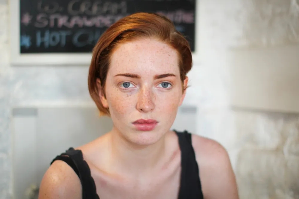 A freckled woman with clear skin