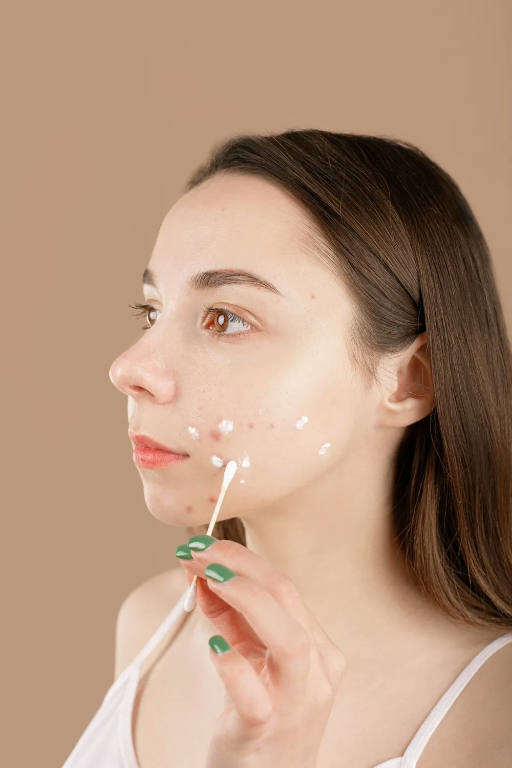 A woman applying a white cream on spots on her face